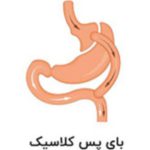 معرفی تمام عملهای لاغری نوین+ مقایسه+مزایا+هزینه و...