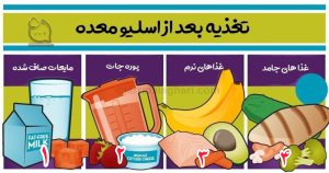 رژيم غذایی بعد از اسلیو معده
