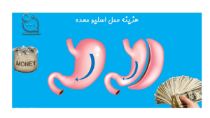 هزینه عمل اسلیو معده قیمت 1402