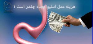 هزینه عمل اسلیو معده قیمت 1402