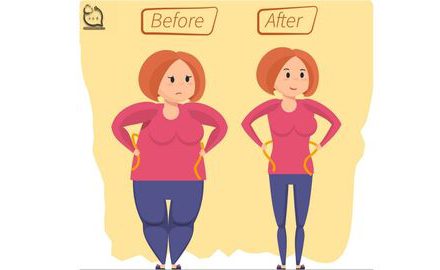 گالری عکس های قبل و بعد از عمل لاغری راهنما درمان