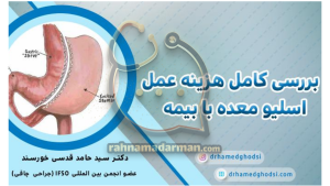 هزینه عمل اسلیو معده بابیمه