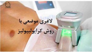 لاغری با دستگاه Slimming with the device