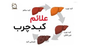 علائم کبد چرب در زنان و مردان