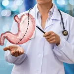 چگونه بعد از انتخاب دکتر اسلیو معده از عوارض خطرناک عمل لاغری دوری کنیم