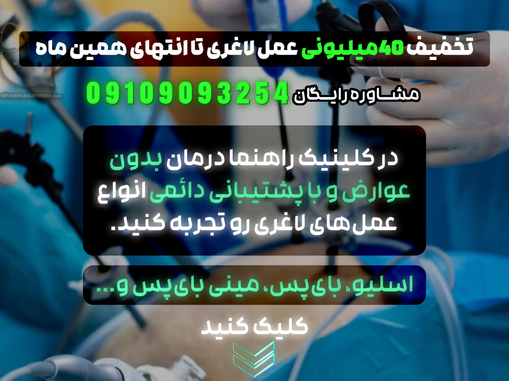 بهترین دکتر اسلیو معده در تهران