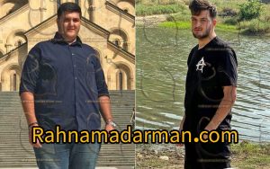 پس از بایپس معده 2