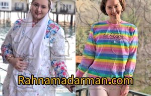 پس از بایپس معده 3