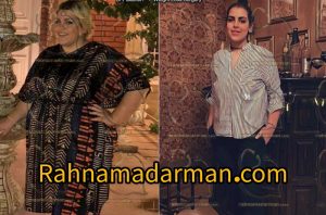 پس از بایپس معده 4