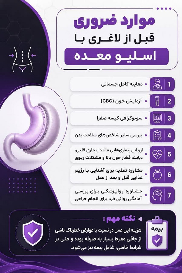 لاغری با اسلیو معده۵۰4